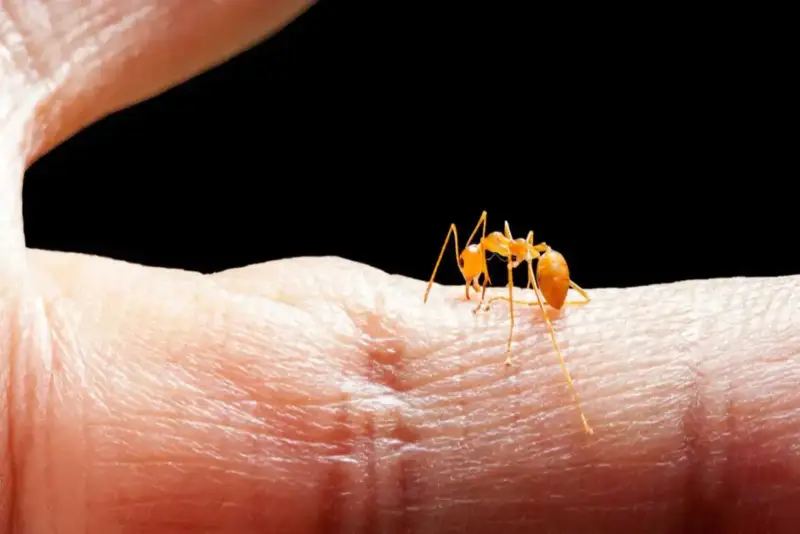 Ant stinging a finger